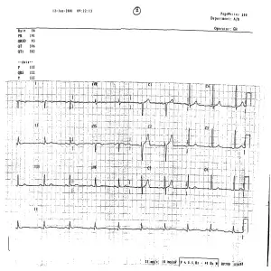 2001 ECG resolution 2